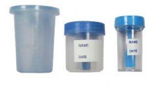 urine stool specimen container